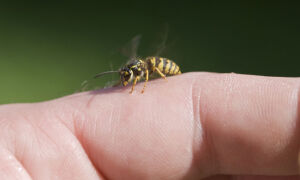 Что делать, если укусила оса 🐝