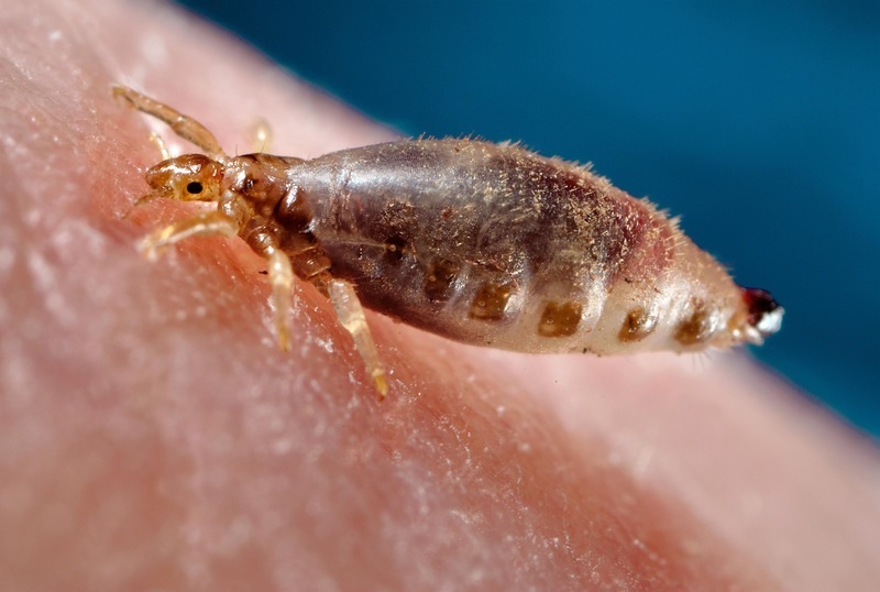 Вошь